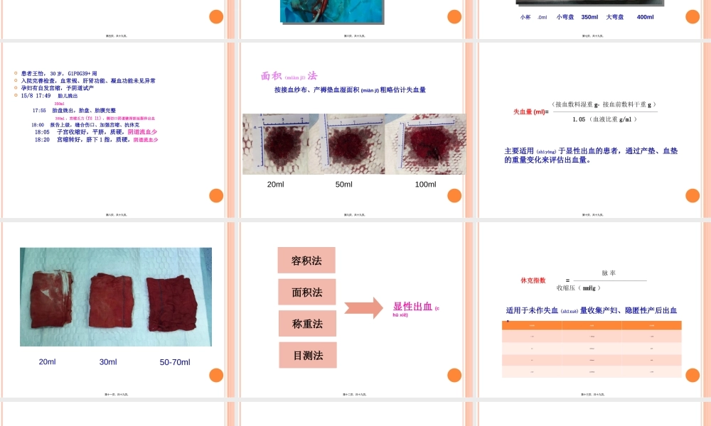 2022年医学专题—产后出血之出血量评估.ppt