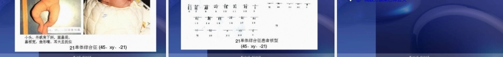 2022年医学专题—人类染色体与染色体病解读.ppt