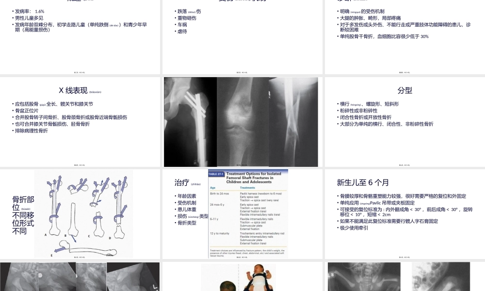 2022年医学专题—儿童股骨干骨折.pptx