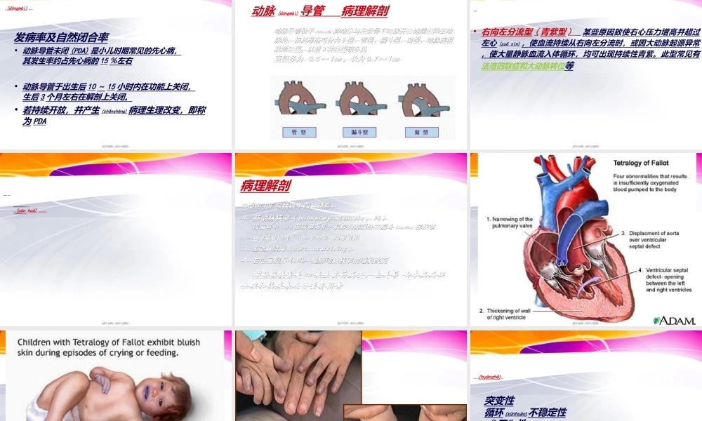 2022年医学专题—先心病概述及术后监护.ppt