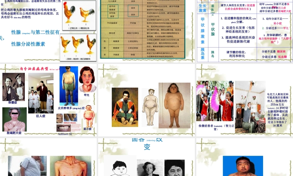 2022年医学专题—内分泌系统常见症状与体征.ppt