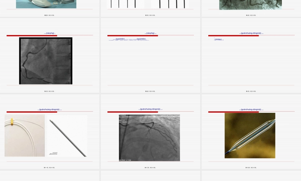 2022年医学专题—冠心病介入诊疗是怎么回事？.ppt