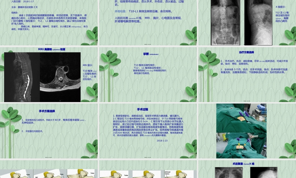 2022年医学专题—压缩性骨折病例分析.pptx