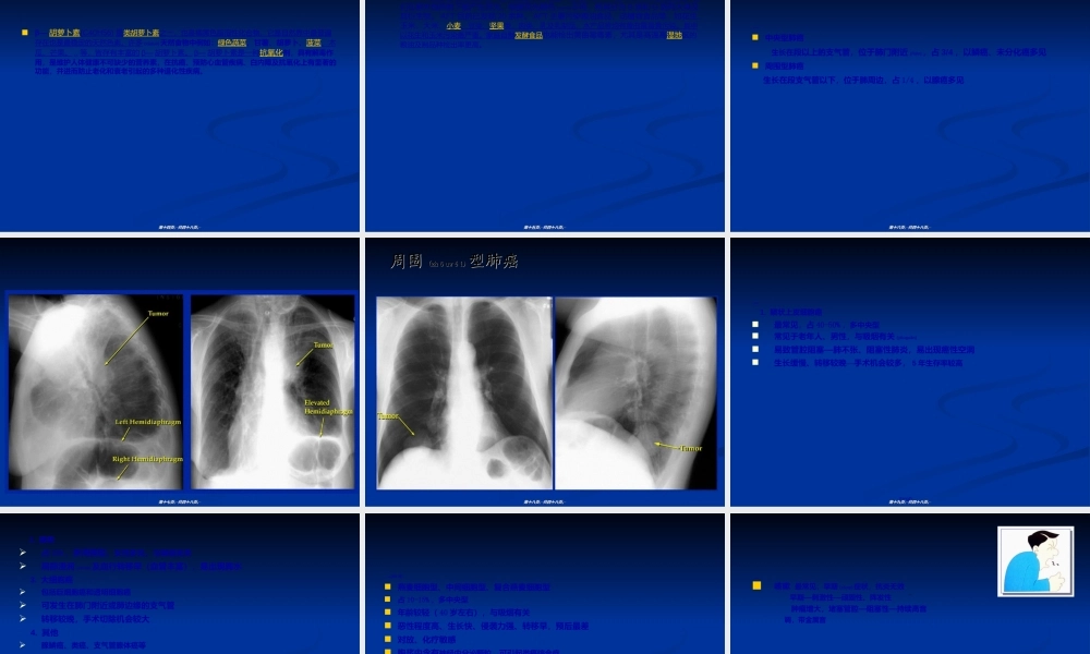 2022年医学专题—原发性支气管肺癌详解.ppt