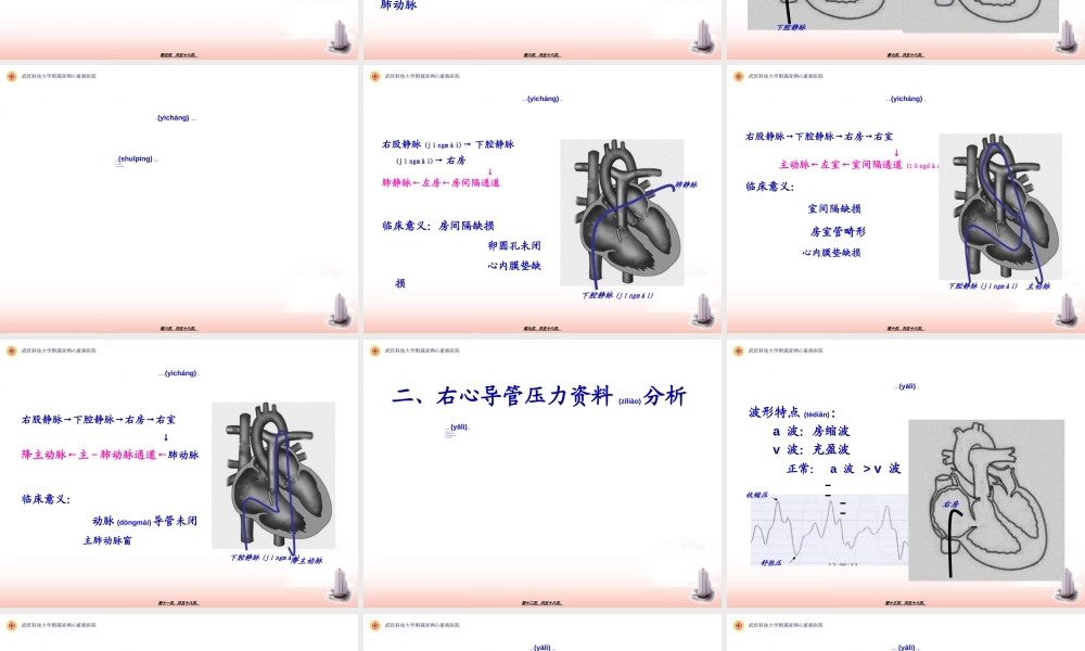 2022年医学专题—右心导管检查及心血管造影.ppt