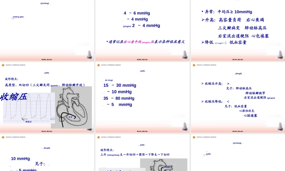 2022年医学专题—右心导管检查及心血管造影.ppt