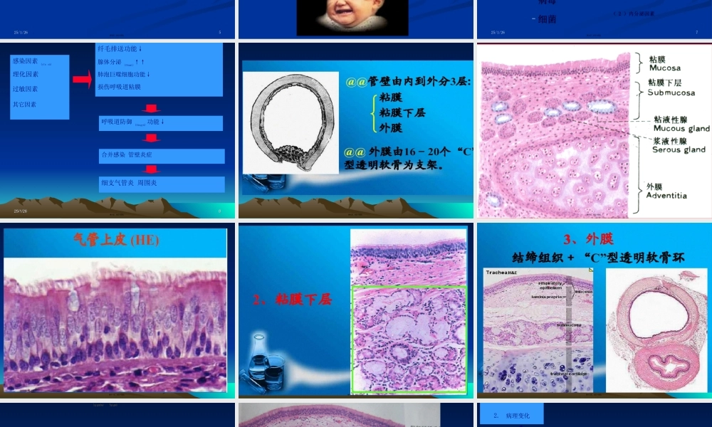 2022年医学专题—呼吸-1.ppt