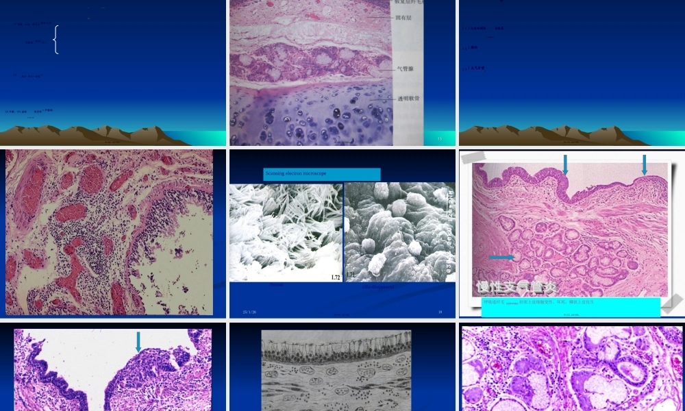 2022年医学专题—呼吸-1.ppt