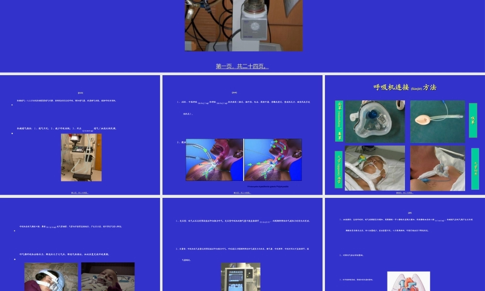 2022年医学专题—呼吸机参数调节和监测.ppt