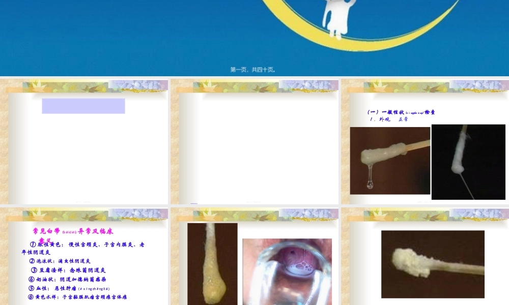 2022年医学专题—四、前列腺液及分泌物检查剖析.ppt