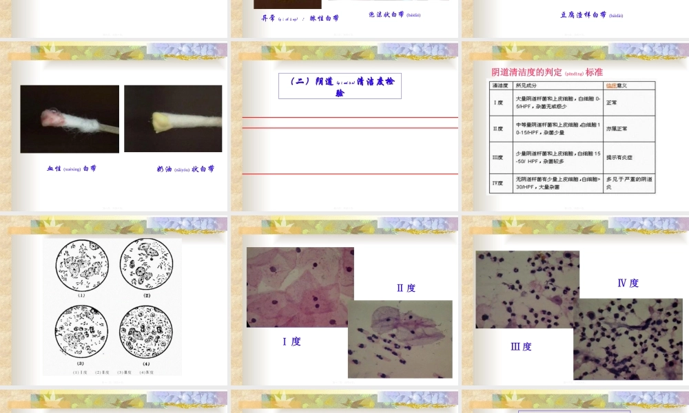 2022年医学专题—四、前列腺液及分泌物检查剖析.ppt