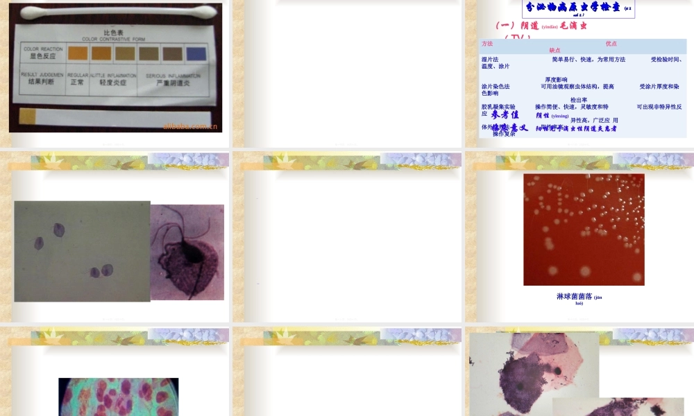 2022年医学专题—四、前列腺液及分泌物检查剖析.ppt