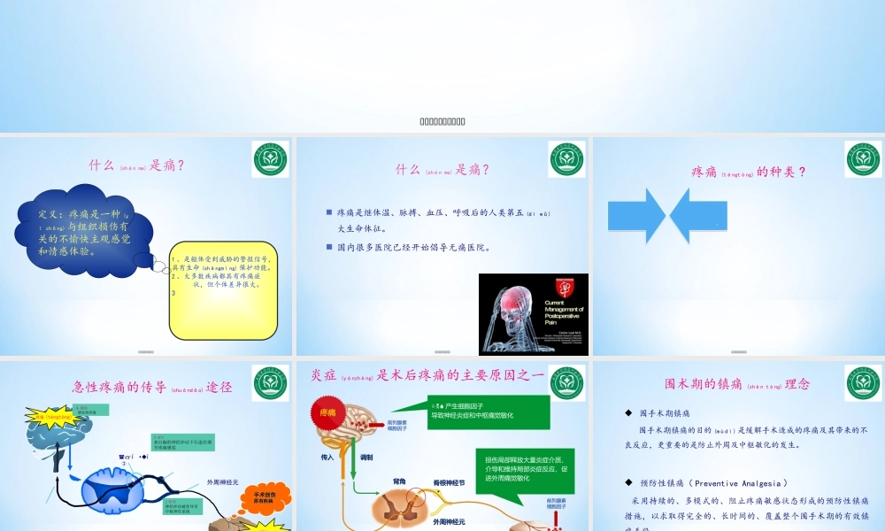2022年医学专题—围术期镇痛现状与思考.ppt