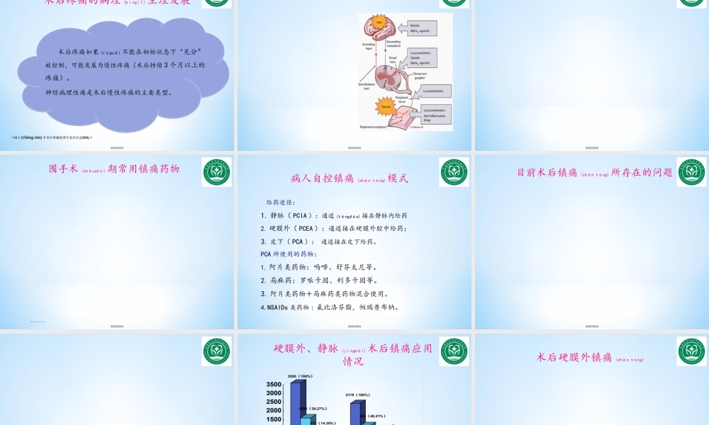 2022年医学专题—围术期镇痛现状与思考.ppt