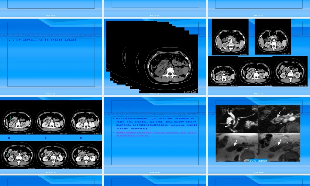 2022年医学专题—壶腹部占位检查方法.ppt