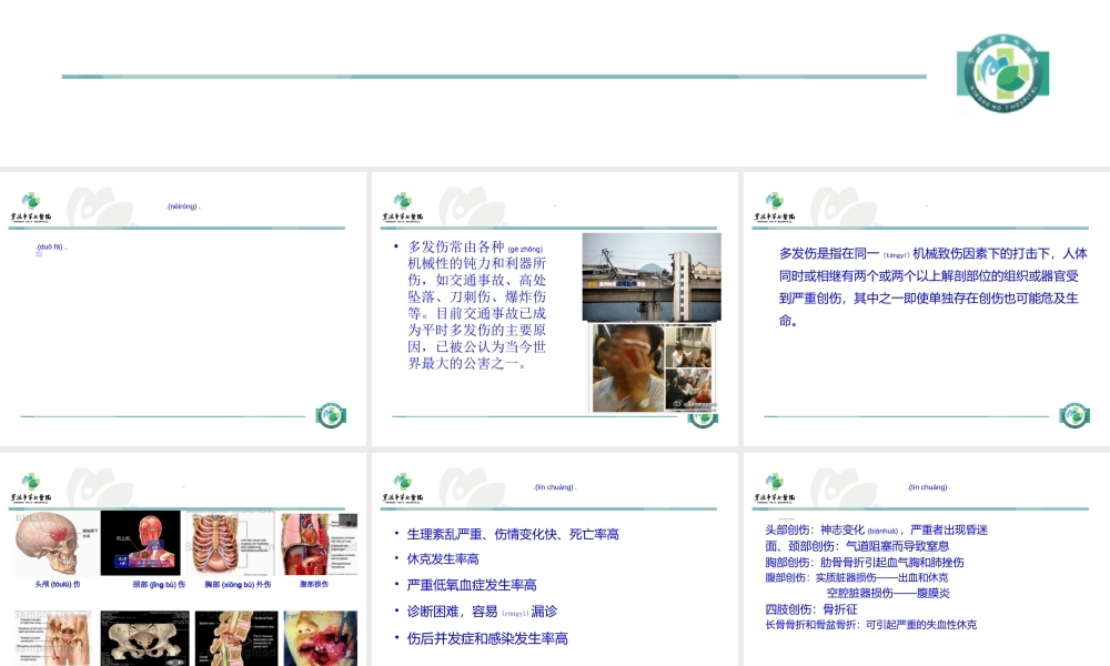 2022年医学专题—多发伤的急救.ppt