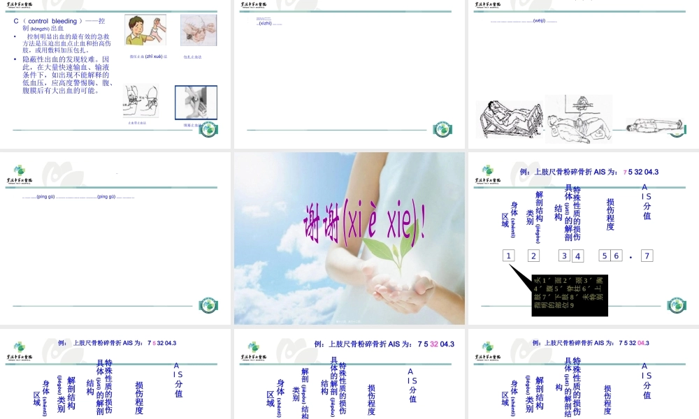 2022年医学专题—多发伤的急救.ppt