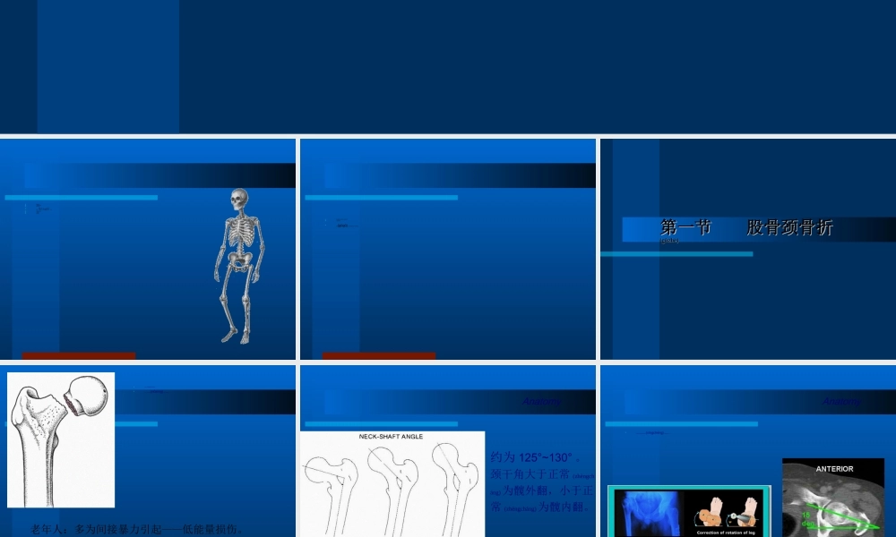 2022年医学专题—下-肢-骨-折.ppt