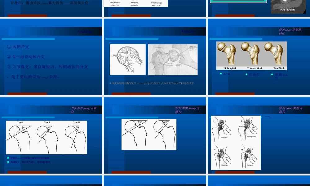 2022年医学专题—下-肢-骨-折.ppt