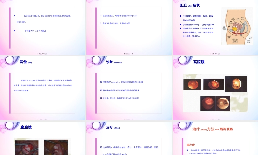 2022年医学专题—子宫肌瘤.pptx