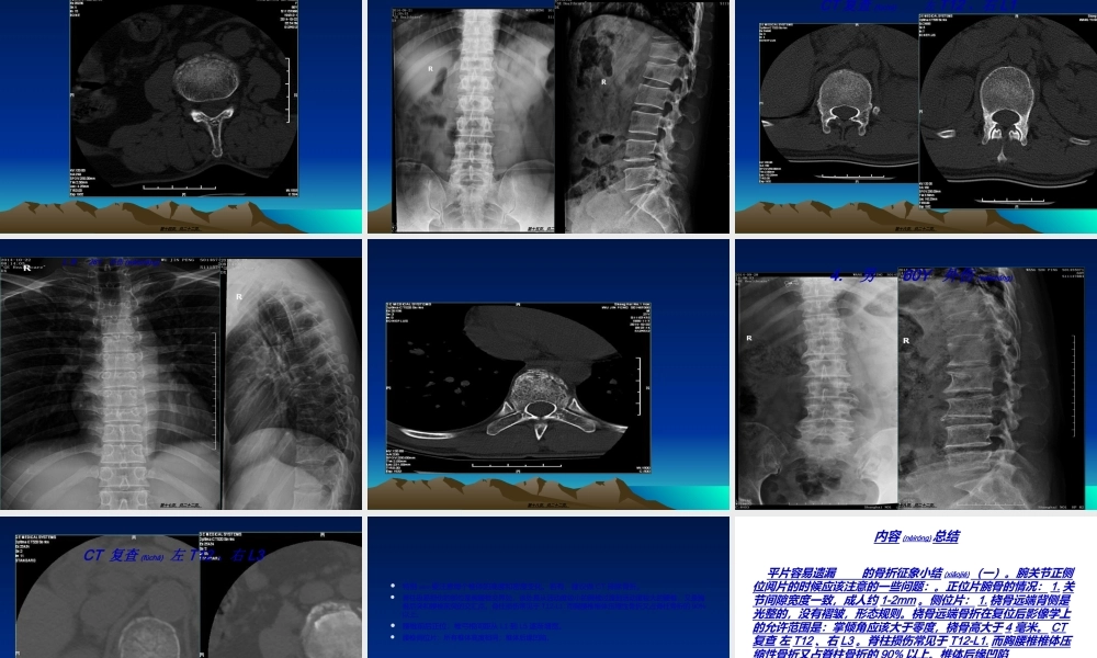 2022年医学专题—容易遗漏骨折.整理.ppt