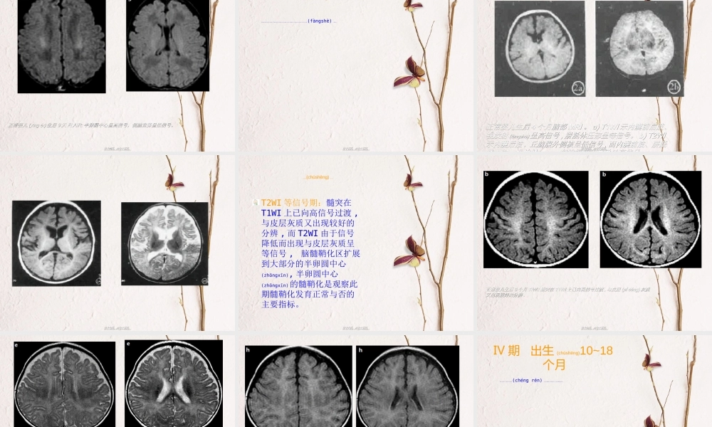 2022年医学专题—小儿脑髓鞘形成MRI.ppt