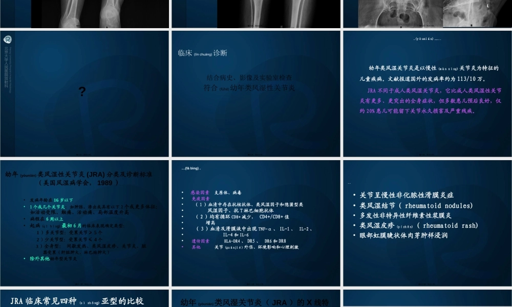 2022年医学专题—幼年类风湿性关节炎资料.ppt