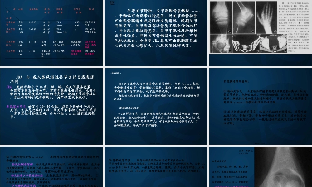 2022年医学专题—幼年类风湿性关节炎资料.ppt