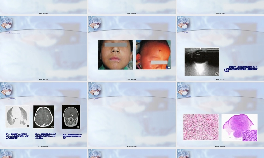 2022年医学专题—幼年性黄色肉芽肿.ppt