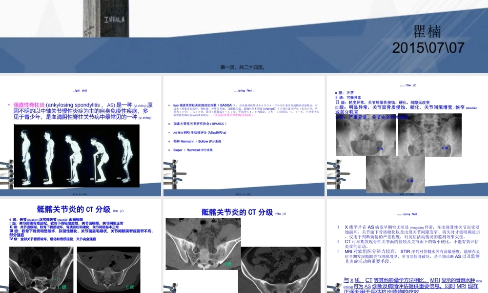 2022年医学专题—强直性脊柱炎MRI评分.ppt