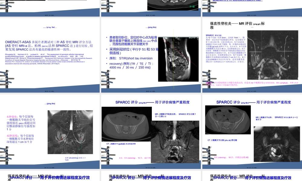2022年医学专题—强直性脊柱炎MRI评分.ppt