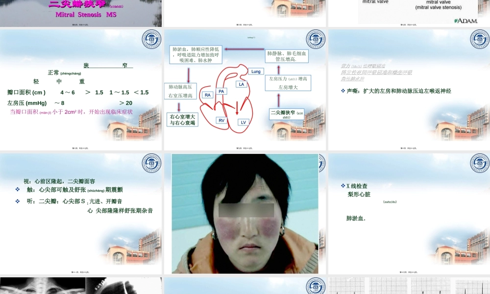 2022年医学专题—心瓣膜病2015(检验系)标准版.ppt