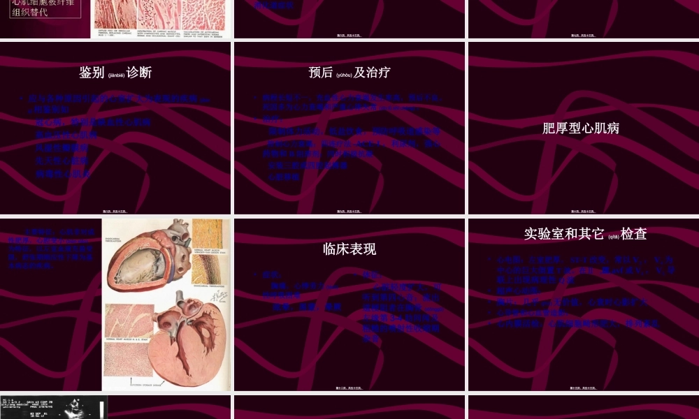 2022年医学专题—心肌病心肌炎.ppt