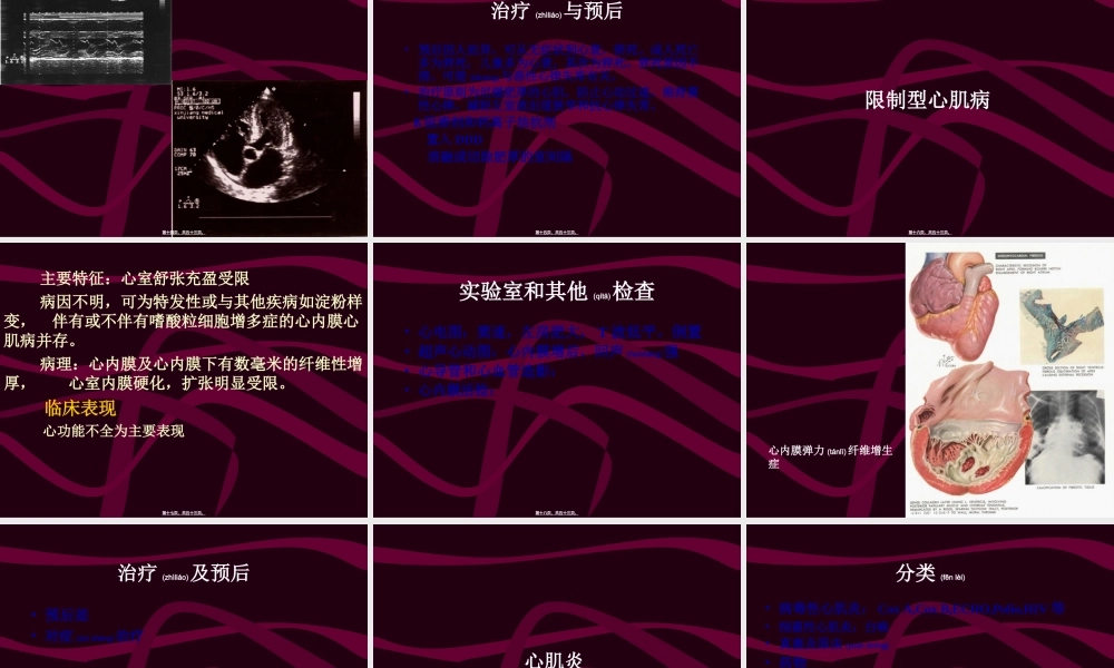 2022年医学专题—心肌病心肌炎.ppt