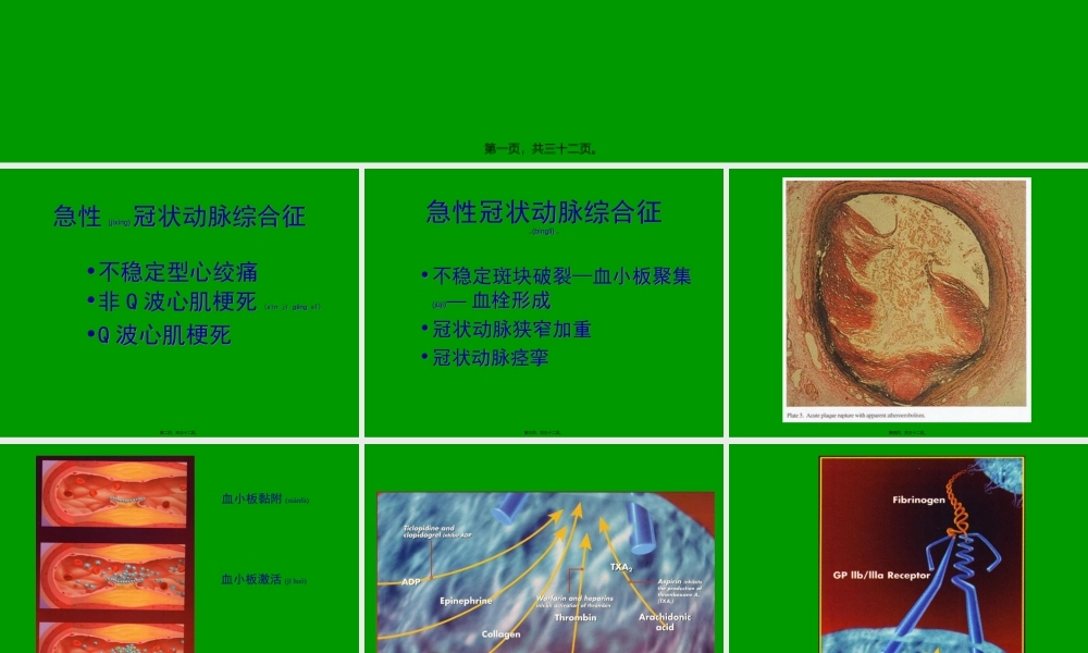 2022年医学专题—急性冠状动脉综合征.ppt