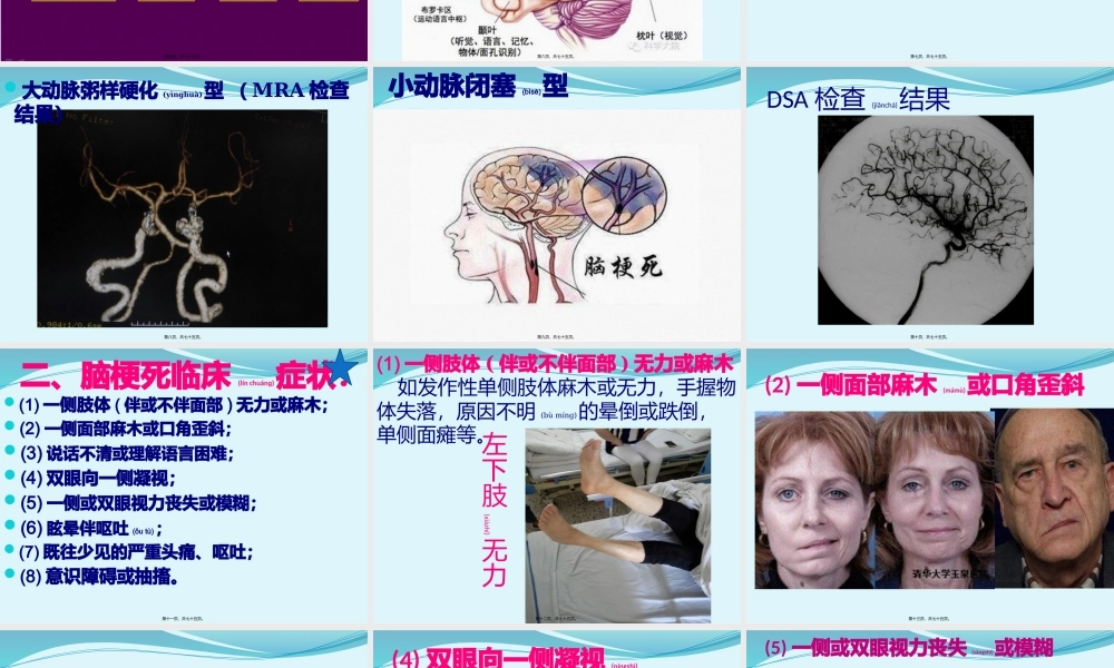 2022年医学专题—急性缺血性脑卒中诊疗规范.pptx