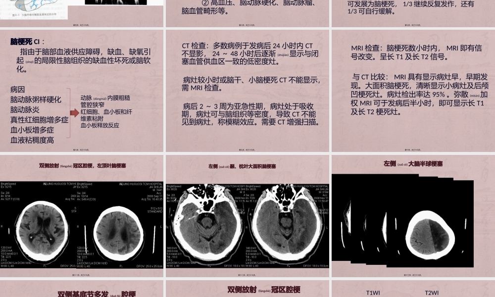 2022年医学专题—急性脑血管病.pptx