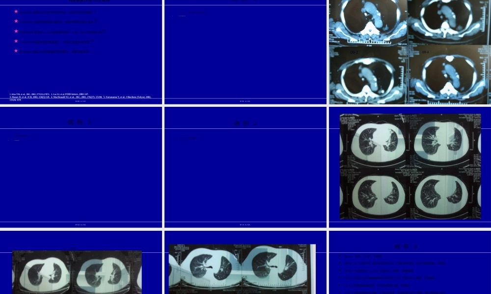 2022年医学专题—恩度病例分享郭沁香.ppt