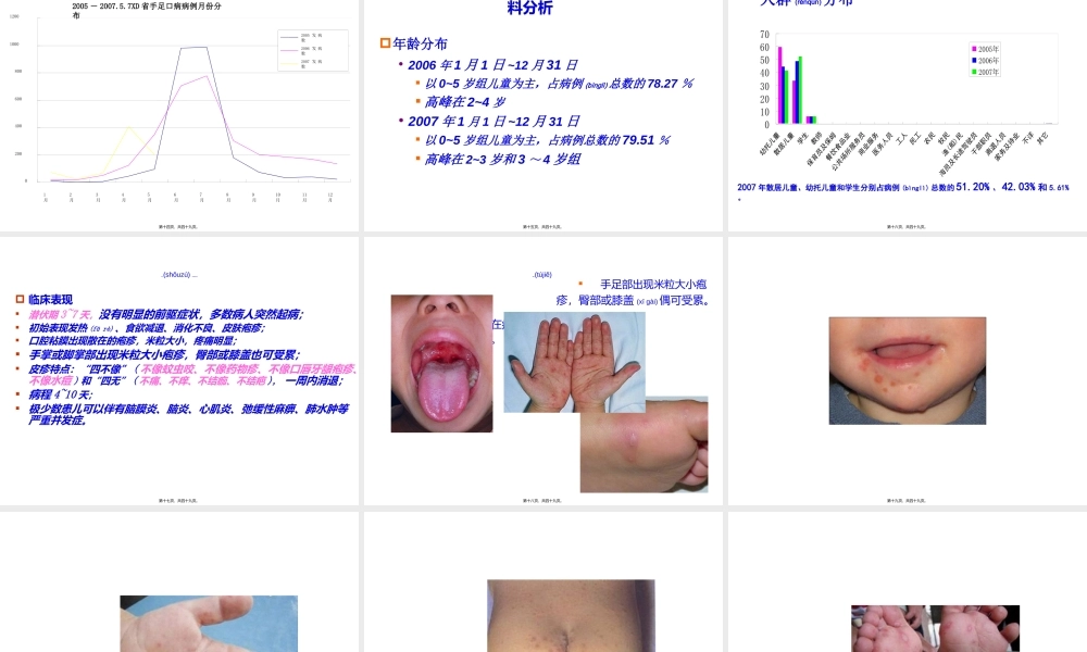 2022年医学专题—手足口病流行概况与防控要点.ppt