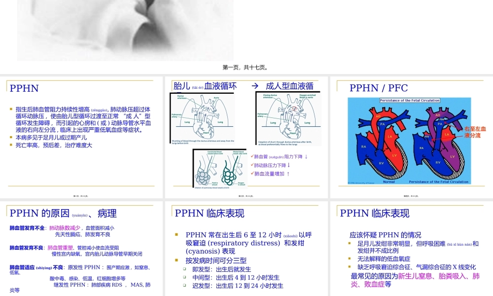 2022年医学专题—新生儿肺动脉高压.pptx