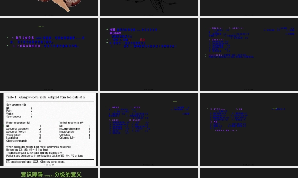 2022年医学专题—昏迷的诊治与植物人、脑死亡.ppt