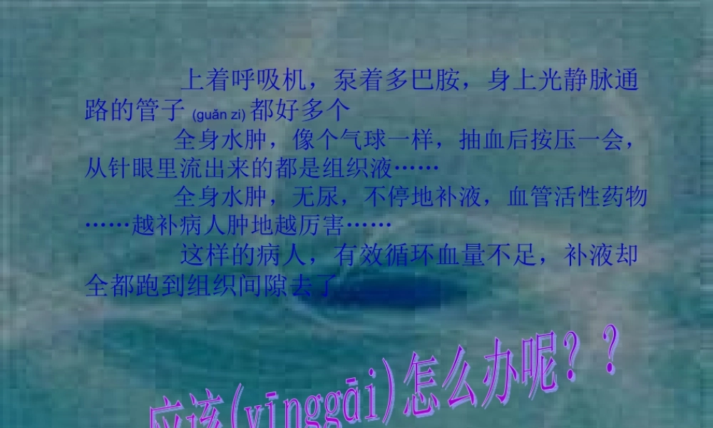 2022年医学专题—毛细血管渗漏综合征.ppt