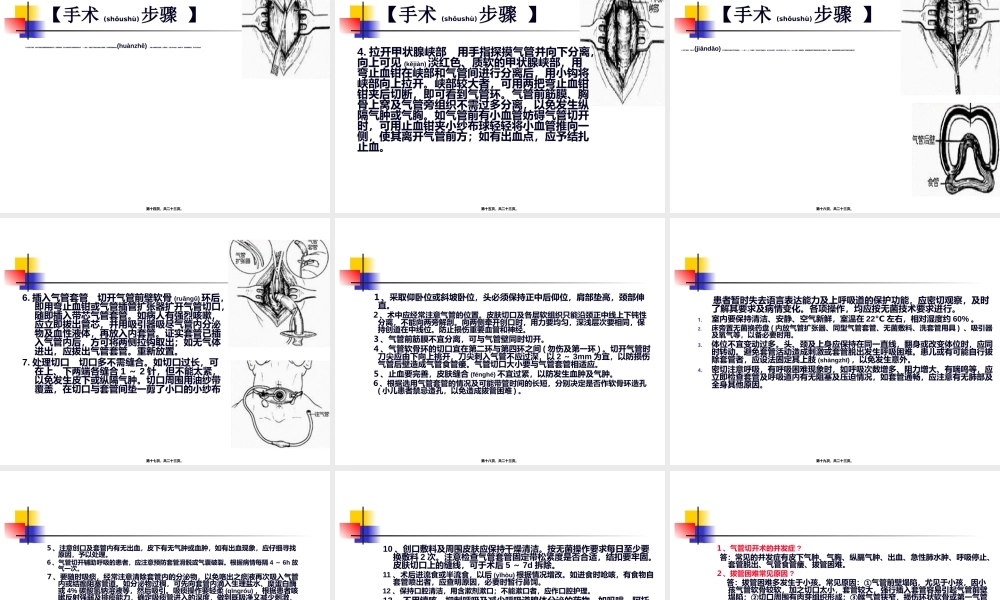 2022年医学专题—气管切开及环甲膜穿刺.ppt