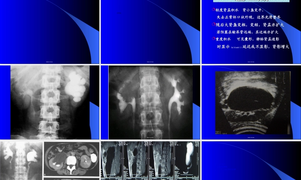 2022年医学专题—泌尿系统梗阻概论.ppt