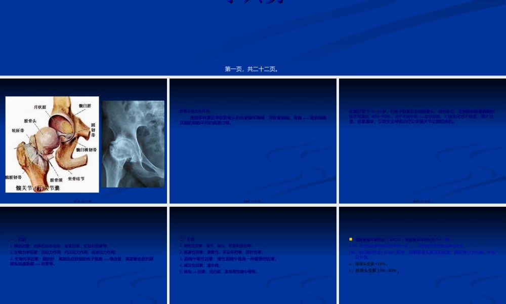 2022年医学专题—浅析股骨头无菌性坏死浅论.ppt