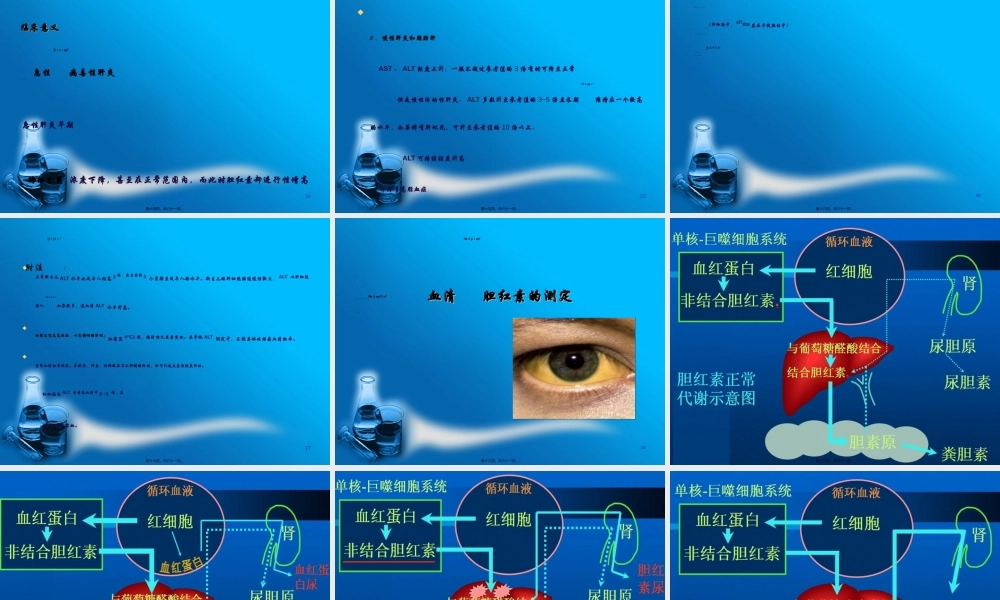 2022年医学专题—生化检验(肝功).ppt