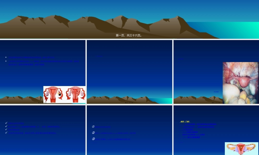 2022年医学专题—盆腔子宫内膜异位症.ppt