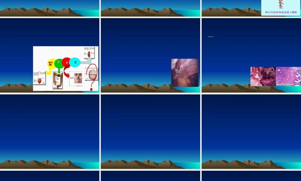 2022年医学专题—盆腔子宫内膜异位症.ppt