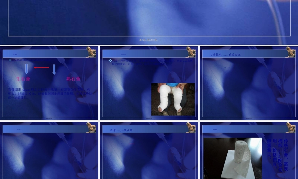 2022年医学专题—石膏固定术.ppt