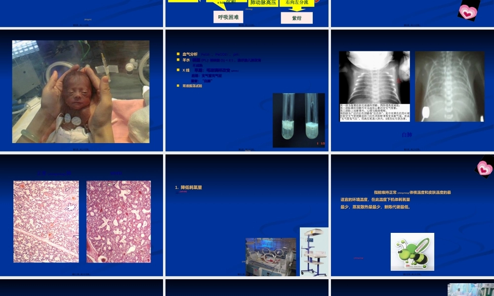 2022年医学专题—第八节-新生儿肺透明膜病.ppt